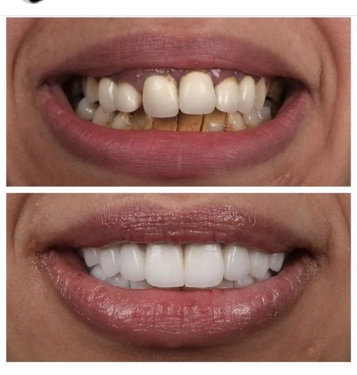 Alanya HEALTHY TEETH Dental Aesthetic — Medicina em Alanya: Encomenda online, preços e comentários